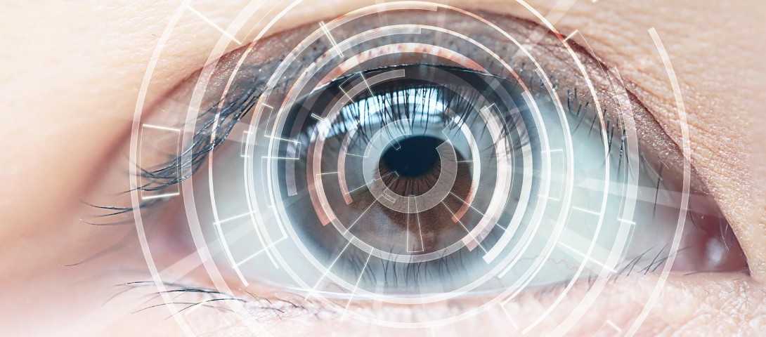 ICL(眼内コンタクトレンズ)治療